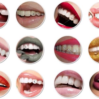 Kit Joyas Dentales - Imagen 2